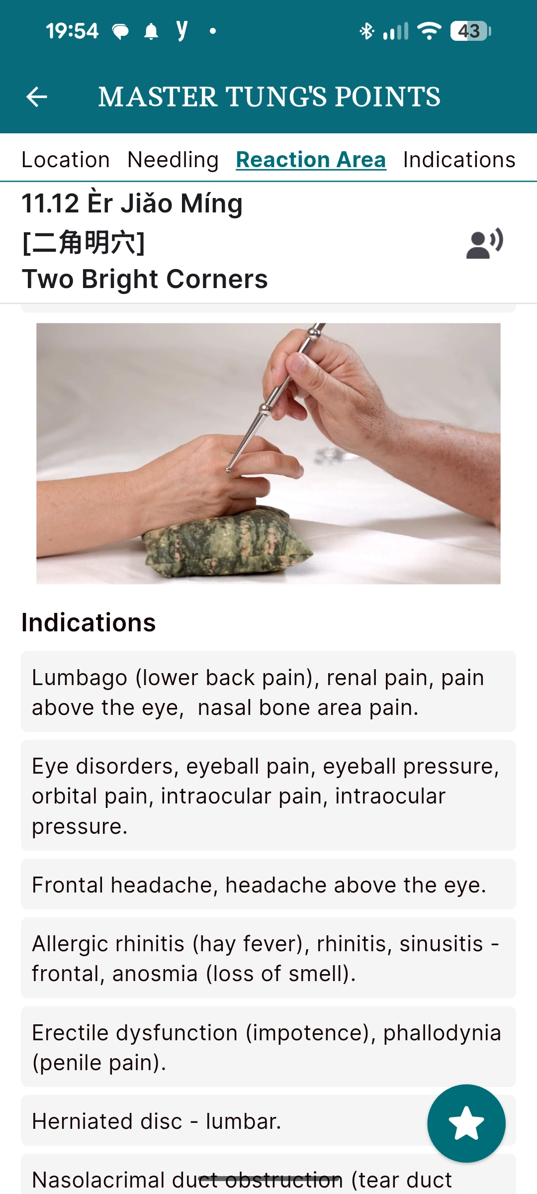 Point 11.12 Ěr Jiáo Míng (Two Bright Corners) — needling demonstration and clinical indications in the Master Tung's Points app