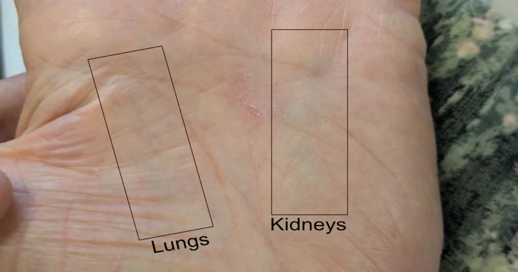 Master Tung palm diagnosis